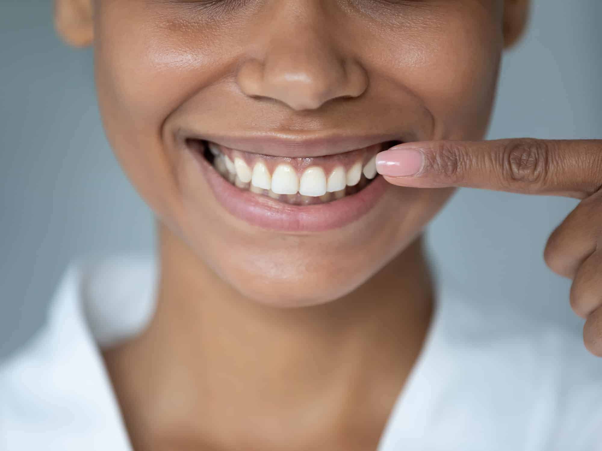 Improve the ROI of Your Best Dental Patients